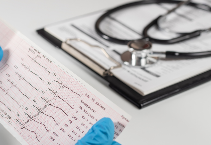 Imagem de um eletrocardiograma sendo segurado com luvas azuis, ao fundo um estetoscópio e um prontuário médico.